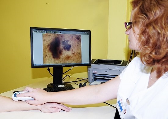 dermatoskop